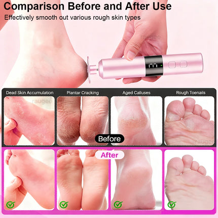 Electric Foot Callu Remover Rechargeable Foot File Foot Care Heel Dead Skin Cuticle Remover Electric Foot Grinder with Sandpaper