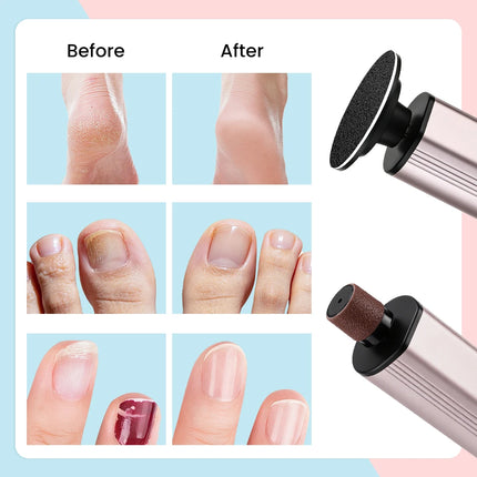 New Electric Foot Callus Remover 9-Speed LCD Rechargeable Foot Care File Dead Skin Remover Pedicure Tool Set 20PCS Sandpaper
