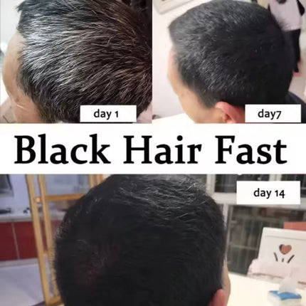 Natural Hair Care Essence Serum Anti Gray Nourish Repair For All Hair Types