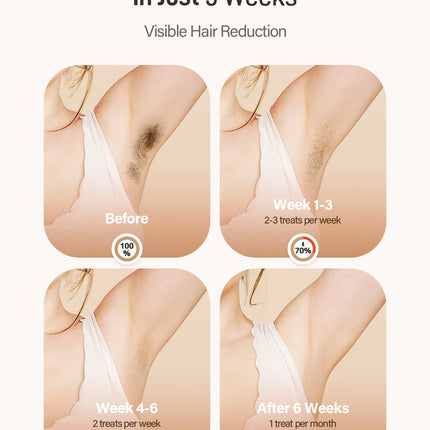 Laser Hair Removal IPL Device 999900 Flashes Dual Flashes Mode 3 Weeks Visible for Women Men Home Laser Quick Safe Treament