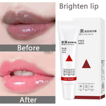 Remove Dark Lip Balm Fast Lightening Pink Lip Exfoliating Fade Lip Line Dead Skin Moisturizer Korean Care Products Beauty Health