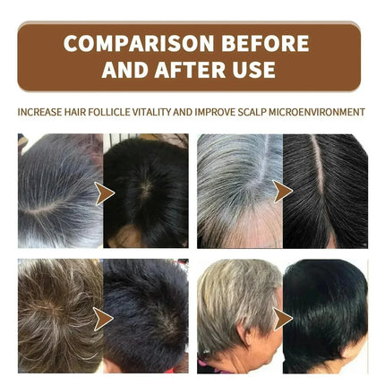 Natural Hair Care Essence Serum Anti Gray Nourish Repair For All Hair Types