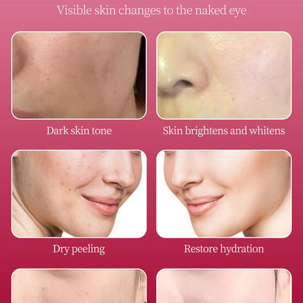Facial Stem Cells Serum Salmon+VC+Peptide +Nicotinamide Oxygen Spray Dermapen 4 Different Booster Ampule Kit  Jet Care Peeling