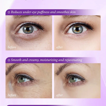 Instant Eye Bag Removal Cream Retinol Anti-Wrinkle Firming Skin Fade Fine Lines Anti Dark Circle Puffiness Brighten Eye skinCare