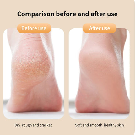 Electric foot grinder for quick removal of dead skin and calluses, suitable for two types of grinding heads and two speeds