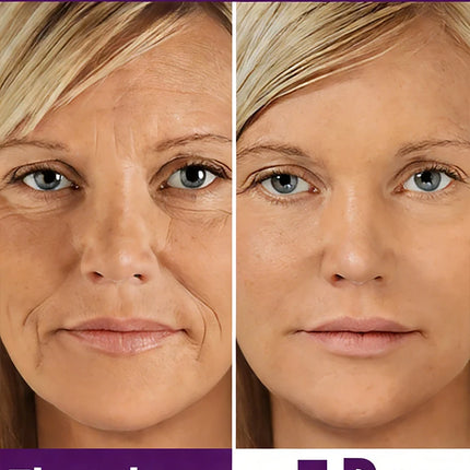 2026 new age-preventive，20 years younger
