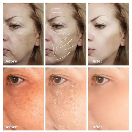Niacinamide Whitening Spot Removal Cream Dark Spot Corrector Face Cream Melasma Freckle Sun Spot Remover Brighten Anti-Aging 30g
