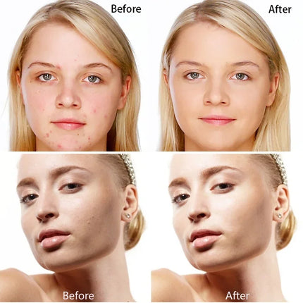14 Colors Concealer Cream Stick Long Lasting Waterproof Concealer Foundation Soft Spotted Acne Mark Makeup Cover Cosmetics