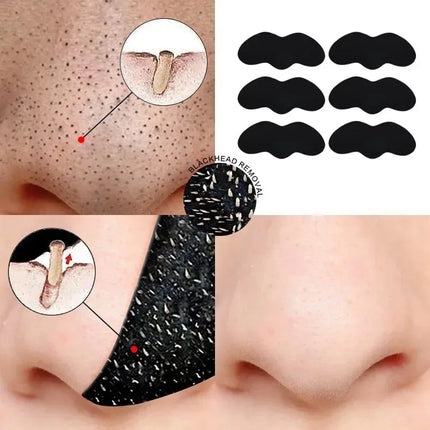 10/20/30Pcs Deep Cleansing Pore Nose Black Head Removal Stickers Peel Off Blackhead Remove Mask Nasal Strips Unisex Skin Care