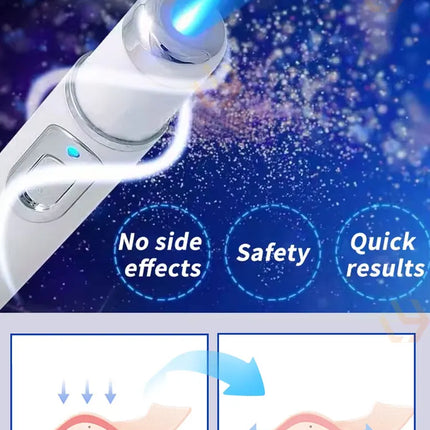 2 generation laser pens to solve your scar problems and keep your skin healthy
