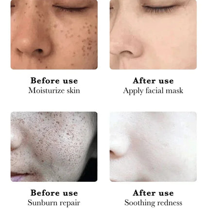 Niacinamide Whitening Spot Removal Cream Dark Spot Corrector Face Cream Melasma Freckle Sun Spot Remover Brighten Anti-Aging 30g