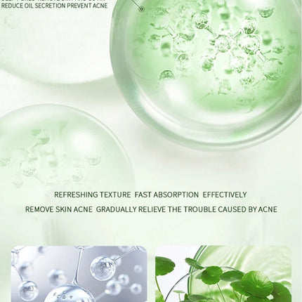 Anti-Acne Cream Effectively Removes Skin Nodules Pustules Cysts Papules Blackheads Men And Women Acne Skin Care Essence Cream