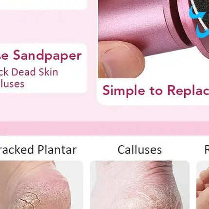 USB Electric Foot Callus Remover Foot Care Tool Leg Heels Remove Dead Skin Pedicure Tool Set With Replacement Sandpaper
