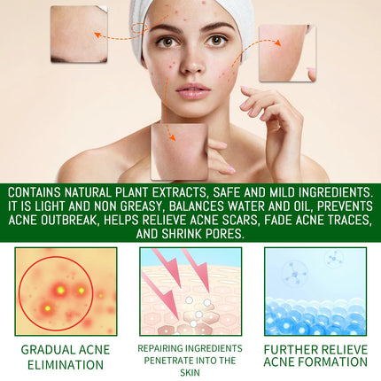 Salicylic Acid Anti Acn-e Face Serum Hydrating Fader Acne Mark Pimple Blackhead Removal Shrink Pores Oil Control Facial Essence
