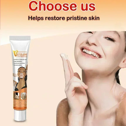 [New] Vitiligo Cream Vitiligo Remover Tinea Versicolor Body Lotion Helps Get Rid of Sweat Spot Vitiligo, Skin Vitiligo Clear