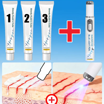 Striae Laser Device Eliminate Body Stretch Marks Products