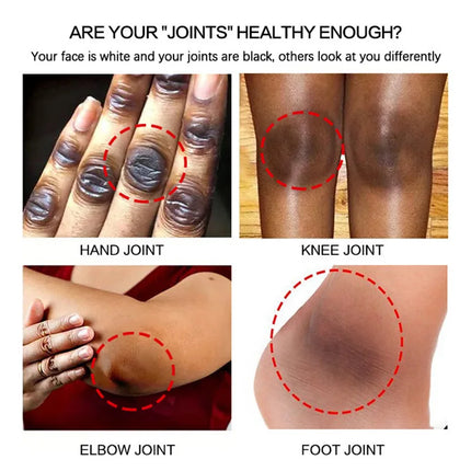 Fast Whitening Dark Knuckles Brighten Hand Cream Melanin Corrector Moisturizing Intense Stains Remover Products Korean Skin Care