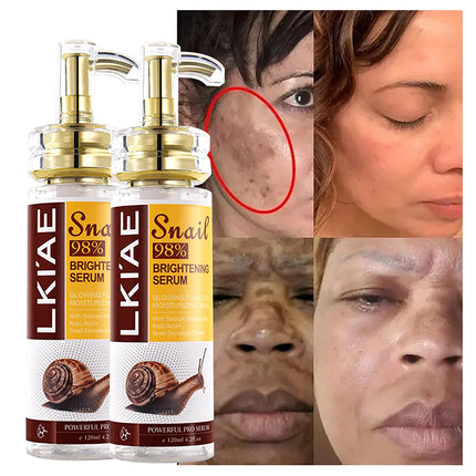 Natural Snail Brightening Face & Body Serum, Glowing Flawless, Moisturizing, Anti-Age, Reduce Spots & Wrinkles, 120ml/ 4.2 oz