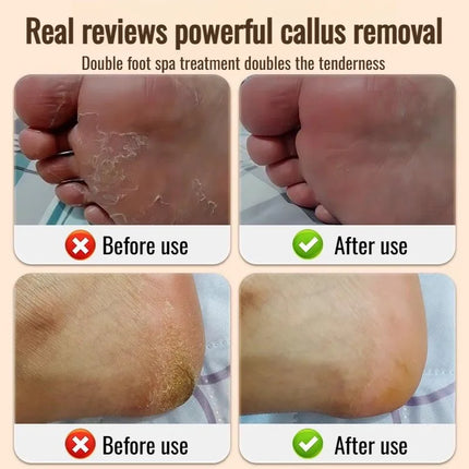 Electric Foot Grinder Electric Peeling Sensor Pedicure Tool Set Full Body Washable Automatic Heel Foot Skin Grinding