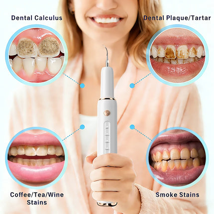 CURVY MOON Ultrasonic Electric Teeth Cleaner Plaque Remover T5 UV Disinfection Pet Dog Cat Use Dental Tartar Calculus Remover