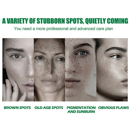 Dark Spot Correcting Glow Serum,Dullness,Acne,And Melanin Remover,Niacinamide Facial Skin Moisturizing Brightening Skincare