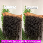 HD 5x5 Closure Only / 14inches
