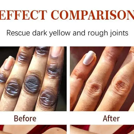 Fast Whitening Dark Knuckles Brighten Hand Cream Melanin Corrector Moisturizing Intense Stains Remover Products Korean Skin Care