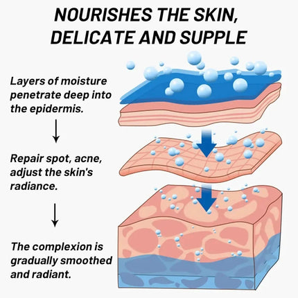 Niacinamide Whitening Spot Removal Cream Dark Spot Corrector Face Cream Melasma Freckle Sun Spot Remover Brighten Anti-Aging 30g