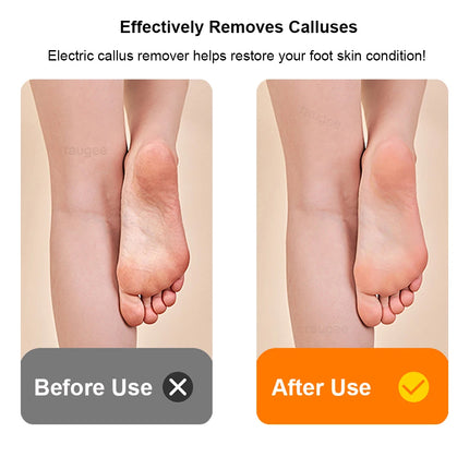 Electric Foot Grinder Mini Portable Foot Callus Remover USB Rechargeable Foot Exfoliation Predicure Grinding Dead Skin Remover