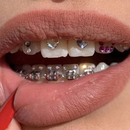 NEW Teeth Decorations 37% Acid Etching Gel Light Cure Adhesive Flowable Composite Professional Diy Crystal Jewelry Tooth Gem Kit