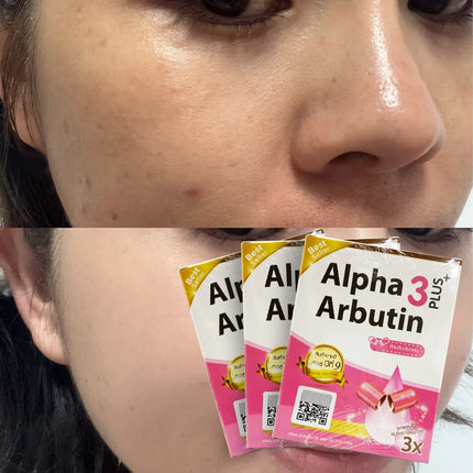 3 boxes Alpha Arbutin 3 Plus Powder Mix With Lotion Skin Lightening Brighten Reduce Dark Skin Blemishes