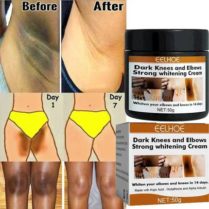 Dark Knuckles Fast Brighten Cream Elbows Hand Knuckle Brightening Serum Knee Black Skin Quickly Lighten Stains Remover Products