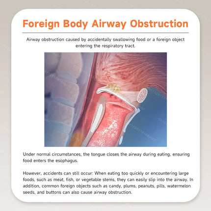 Auto Cpr First Aid Device Anti Asphyxia Rescue Devices Portable Home Outdoor Heimlich Emergency Machine for Adult and Child