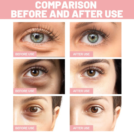 Pink Rose Eye Mask - Anti-Wrinkle & Dark Circle Treatment, Hydrating Under Eye Patches, Firming & Brightening Eye Care