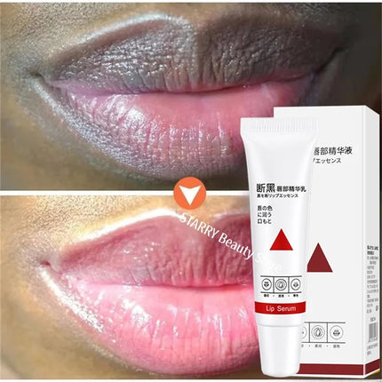 Remove Dark Lip Balm Fast Lightening Pink Lip Exfoliating Fade Lip Line Dead Skin Moisturizer Korean Care Products Beauty Health
