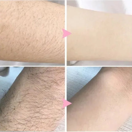 Hair removal spray powerful hair part healthy painless hair removal growth inhibitor male and female body care Korean products