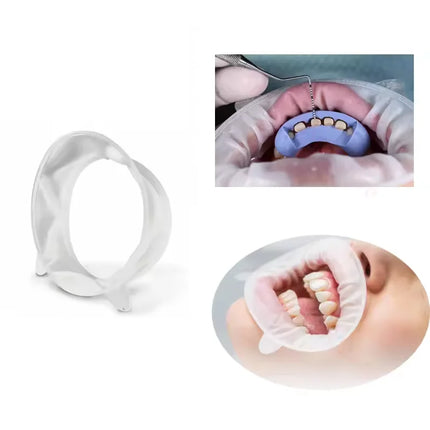 10 Piece Dental Mouth Opener 3D Oral Lip Cheek Retractor O Shape Rubber Expander for Small Junior Dentistry Tools Set