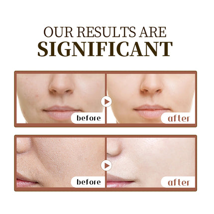 Centella Asiatica Soothing Serum 55ml - Madagascar Formula Calms Sensitive Skin, Supports Acne Care & Deeply Moisturizes.