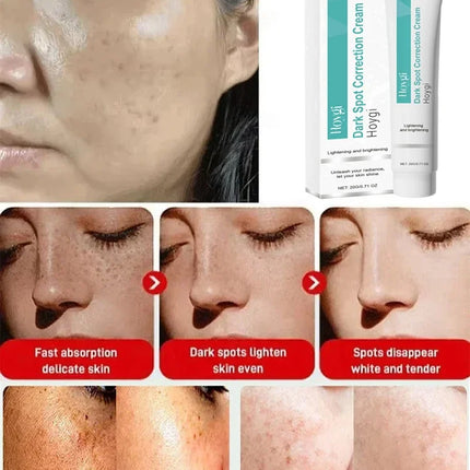 Powerful Spot-removing Whiten Cream Brighten Skin Fast Eliminates Melanin Pigmentation Melasma Dark Spots Moisturize Beauty Gel