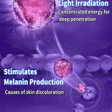 Vitiligo Treatment Device 2nd Upgraded Version⸴Vitiligo Treatment⸴Fast