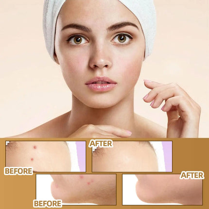 Skin concealing patch-waterproof cover for scars, tattoos, acne marks, birthmarks-natural looking, breathable, reusable