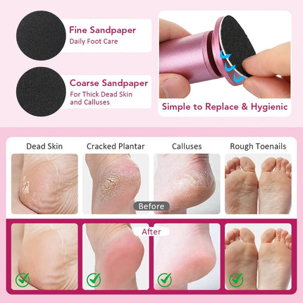 Electric Foot Callus Remover Foot Care File Leg Heels Remove Dead Skin Pedicure Tool Set Foot Grinder & Replacement Sandpaper