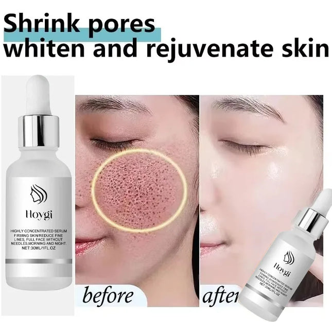 Large Pore Removal Serum, Lactic Acid Facial Pore Shrinking and Repairing Product, Pore Minimizing, Firming, and Smoothing Korean Skin Care.