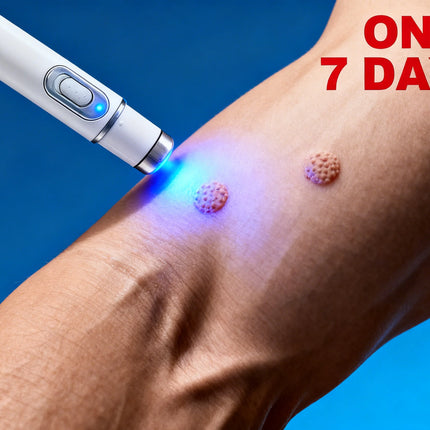Best-Selling Blue Light Pen: Effective for Body Wart Removal & Wart Care 26