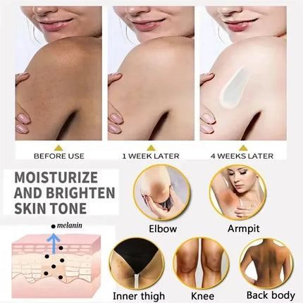 Dark Knuckles Fast Brighten Cream Elbows Hand Knuckle Brightening Serum Knee Black Skin Quickly Lighten Stains Remover Products