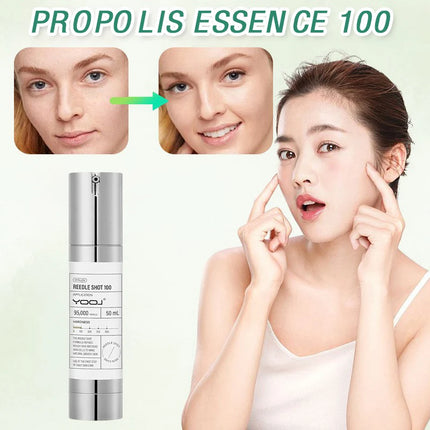 Korean Microneedle Essence Desalination Fine Lines Spots Collagen Solution Reverse Aging Recombinant Improves Rough Texture 50ml