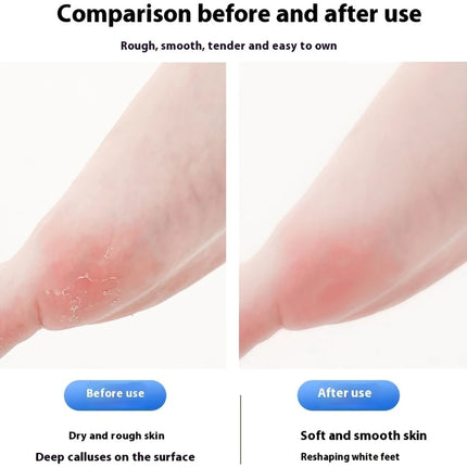 Household Electric Foot Grinder Dead Skin Remover Calluses Feet Scrubber Electric Foot File Dry Dead Cracked Foot Care Repaire