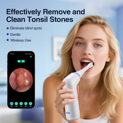 Visible Electric Tonsil Stone Remover Tool Visible Tonsil Stone Removal Kit 3 Suction Modes Tonsil Stone Removal Oral Care