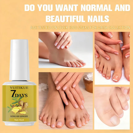 YUITIKUG-Nail Enhancement, Manicure Nails, Pedicure, Gels, Men and Women