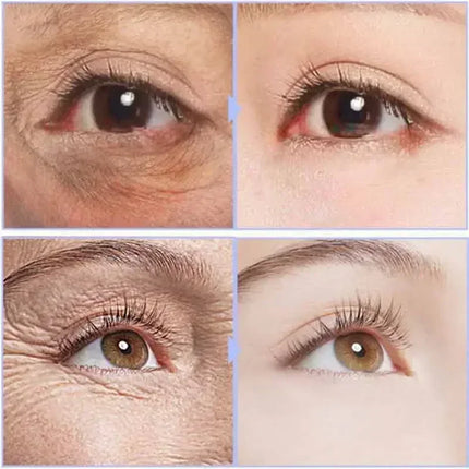Instant Eye Cream For Anti Aging Dark Circles Bags Puffiness Great Under Eye Skin Face Tightening Eye Lift Treatment Care A